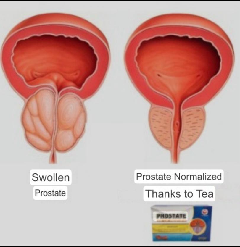 PROSTATE TEA