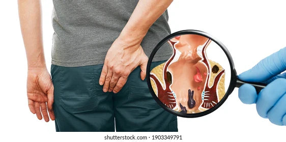 hemorrhoids tea